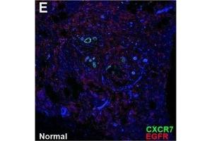 CXCR7 co-localizes with EGFR.