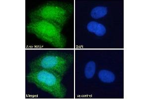 ABIN185368 Immunofluorescence analysis of paraformaldehyde fixed U2OS cells, permeabilized with 0.