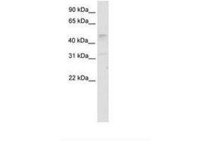 Image no. 1 for anti-Transcription Factor AP-2 gamma (Activating Enhancer Binding Protein 2 Gamma) (TFAP2C) (AA 121-170) antibody (ABIN202551)