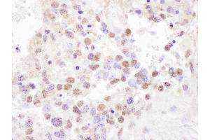 Immunohistochemistry (IHC) image for anti-Interleukin enhancer-binding factor 3 (ILF3) (AA 325-375) antibody (ABIN7453605)