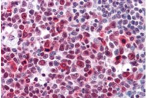 Human Tonsil: Formalin-Fixed, Paraffin-Embedded (FFPE) (HMGB2 anticorps  (AA 1-196))