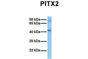 Host:  Rabbit  Target Name:  PITX2  Sample Tissue:  Human MCF7  Antibody Dilution:  1.