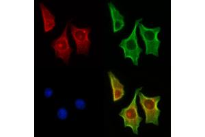 ABIN7094348 and ABIN7098395 staining HepG2 cells by IF/ICC.