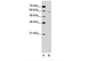 Image no. 1 for anti-Cell Division Cycle 23 (CDC23) (C-Term) antibody (ABIN6736648) (CDC23 anticorps  (C-Term))
