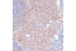 Immunohistochemistry of paraffin-embedded rat spleen using G3BP1 antibody (ABIN7267528) at dilution of 1:100 (40x lens).