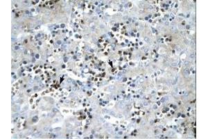 anti-Stearoyl-CoA Desaturase (Delta-9-Desaturase) (SCD) (AA 190-239) antibody