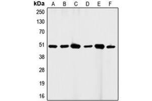 Western blot analysis of CD95 expression in HeLa (A), A431 (B), K562 (C), HL60 (D), mouse brain (E), H9C2 (F) whole cell lysates. (FAS anticorps  (C-Term))
