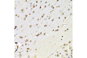 Immunohistochemistry of paraffin-embedded mouse brain using RUNX1 Antibody (ABIN3022803, ABIN3022804, ABIN3022805 and ABIN6219236) at dilution of 1:100 (40x lens). (RUNX1 anticorps  (AA 150-250))