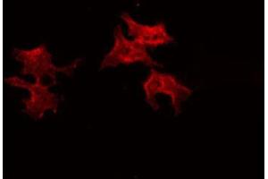 ABIN6266611 staining A549 by IF/ICC. (Dynamitin anticorps  (C-Term))