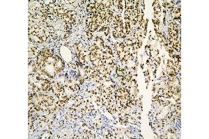 IHC analysis of PHF21A using anti-PHF21A antibody (ABIN6719353). (PHF21A anticorps  (AA 1-97))