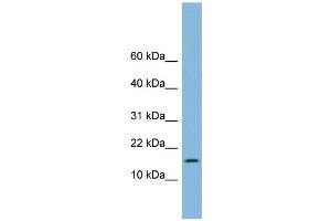 WB Suggested Anti-UBE2L6 Antibody Titration: 0. (UBE2L6 anticorps  (Middle Region))