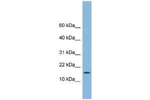 WB Suggested Anti-UBE2L6 Antibody Titration: 0. (UBE2L6 anticorps  (Middle Region))