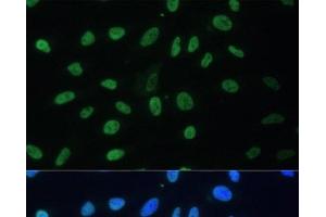 Immunofluorescence analysis of U-2 OS cells using HNRNPD Polyclonal Antibody at dilution of 1:100. (HNRNPD/AUF1 anticorps)