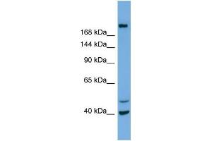 Western Blotting (WB) image for anti-Inositol Polyphosphate-5-Phosphatase F (INPP5F) (N-Term) antibody (ABIN2786063) (INPP5F anticorps  (N-Term))