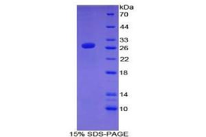 SDS-PAGE analysis of Mouse ATF7 Protein. (AFT7 Protéine)