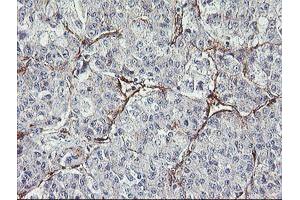 Immunohistochemistry (IHC) image for anti-Mesoderm Induction Early Response 1, Family Member 2 (MIER2) (AA 1-296) antibody (ABIN1490703) (MIER2 anticorps  (AA 1-296))