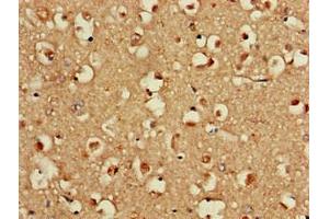 Immunohistochemistry of paraffin-embedded human brain tissue using ABIN7152131 at dilution of 1:100