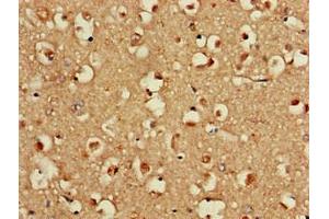 Immunohistochemistry of paraffin-embedded human brain tissue using ABIN7152131 at dilution of 1:100 (EIF2S1 anticorps  (AA 276-315))