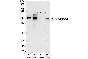 Western Blotting (WB) image for anti-Ataxin 2 (ATXN2) (AA 1262-1312) antibody (ABIN7451571)