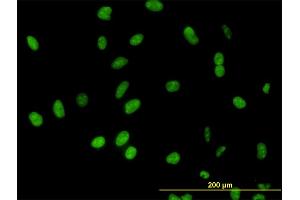 Immunofluorescence of monoclonal antibody to DDX54 on HeLa cell.