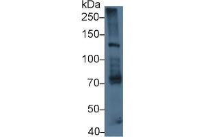 Detection of LAMb3 in Mouse Lung lysate using Polyclonal Antibody to Laminin Beta 3 (LAMb3) (Laminin beta 3 anticorps  (AA 595-778))