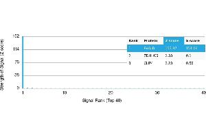 Protein Array (PAr) image for anti-Parvalbumin (PVALB) antibody (ABIN7455989)