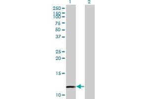 Western Blot analysis of MYCBP expression in transfected 293T cell line by MYCBP monoclonal antibody (M08), clone 1F10.