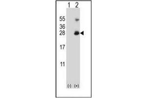 Western blot analysis of RNF11 (arrow) using RNF11 Antibody (Center) Cat. (RNF11 anticorps  (Middle Region))