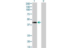 Western Blot analysis of AFF4 expression in transfected 293T cell line by AFF4 monoclonal antibody (M01), clone 2E12. (AFF4 anticorps  (AA 1-108))