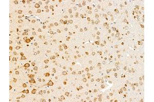 anti-Olfactory Marker Protein (OMP) (Internal Region) antibody