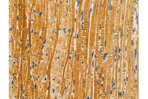 anti-ATP-Binding Cassette, Sub-Family A (ABC1), Member 1 (ABCA1) (pSer2054) antibody