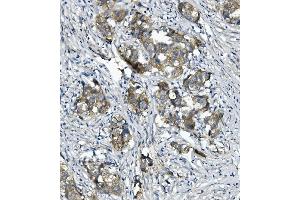 IHC analysis of CTNNA1 using anti-CTNNA1 antibody (ABIN7600057).