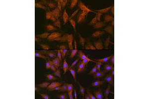 Immunofluorescence analysis of C6 cells using FXR1 Rabbit mAb (ABIN7267257) at dilution of 1:100 (40x lens). (FXR1 anticorps)