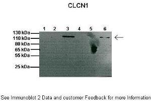 Lanes:   1: 20ug mouse muscle membrane fraction, 2: Empty, 3: 20ug mouse brain membrane fraction, 4: Empty, 5: 20ug mouse muscle cytosolic fraction, 6: 20ug mouse brain cytosolic fraction  Primary Antibody Dilution:   1:1000  Secondary Antibody:   Anti-rabbit HRP  Secondary Antibody Dilution:   1:2000  Gene Name:   Clcn1  Submitted by:   Anonymous