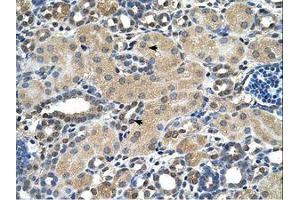 Image no. 1 for anti-Aspartate beta-Hydroxylase (ASPH) (AA 66-115) antibody (ABIN321861)