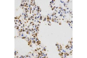 Immunohistochemistry of paraffin-embedded rat spleen tissue using H3K36me3 antibody at dilution of 1:200 (x400 lens).