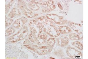 anti-cAMP Responsive Element Binding Protein 1 (CREB1) (pSer133) antibody