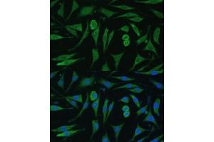 anti-GTPase Activating Protein and VPS9 Domains 1 (GAPVD1) (AA 1-260) antibody