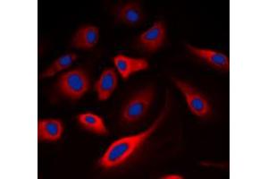 Immunofluorescent analysis of Calmodulin (pT80/S82) staining in A549 cells.