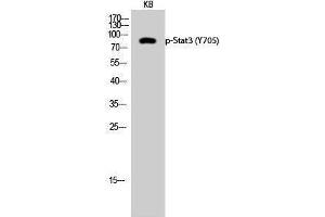 Western Blotting (WB) image for anti-Signal Transducer and Activator of Transcription 3 (Acute-Phase Response Factor) (STAT3) (pTyr705) antibody (ABIN3182150)