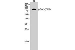 Western Blotting (WB) image for anti-Signal Transducer and Activator of Transcription 3 (Acute-Phase Response Factor) (STAT3) (pTyr705) antibody (ABIN3179505) (STAT3 anticorps  (pTyr705))
