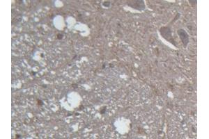 IHC-P analysis of Rat Spinal cord Tissue, with DAB staining.
