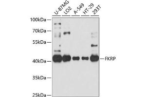 Western blot analysis of extracts of various cell lines, using FKRP antibody (ABIN6132005, ABIN6140666, ABIN6140667 and ABIN6214350) at 1:1000 dilution. (FKRP anticorps  (AA 30-220))
