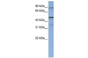 WB Suggested Anti-DAZAP1  Antibody Titration: 0. (DAZAP1 anticorps  (Middle Region))