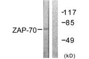 Western blot analysis of extracts from 293 cells, treated with PMA 125ng/ml 30', using ZAP-70 (Ab-292) Antibody. (ZAP70 anticorps  (AA 258-307))