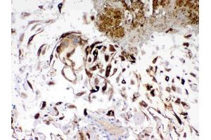 IHC analysis of IGFBP1 using anti- IGFBP1 antibody .