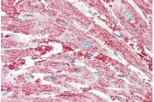 Human Heart: Formalin-Fixed, Paraffin-Embedded (FFPE)