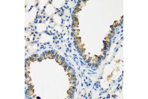 Immunohistochemistry of paraffin-embedded mouse lung using CYP2F1 antibody.