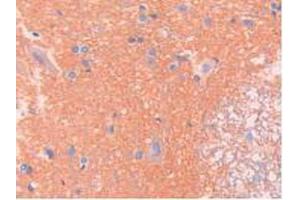 IHC-P analysis of Rat Spinal Cord Tissue, with DAB staining. (SPTAN1 anticorps  (AA 2071-2269))