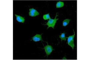 IF analysis of GRB14 using anti-GRB14 antibody (ABIN7599149).